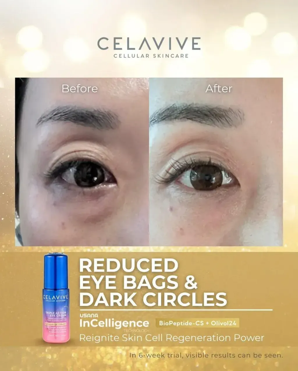 JuzBeauty-JuzBeautyMalaysia-JuzPretty-Authentic-Kbeauty-Malaysia-Skin-Care-Cosmetics-Jbeauty-Health-Care-korean-streetwear-CELAVIVE Lifting Kit 紧致配套10