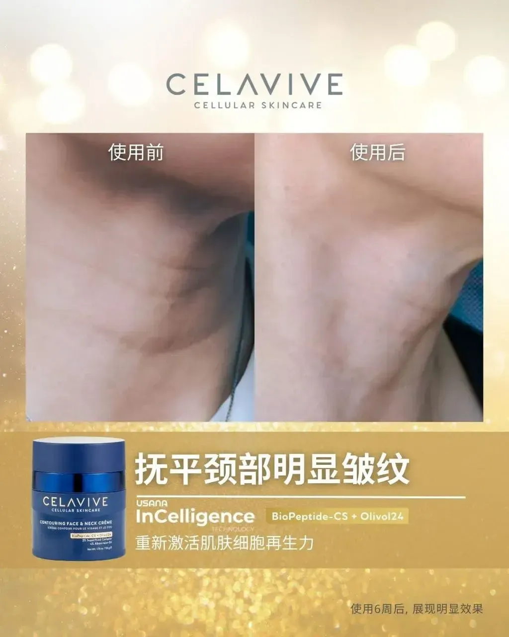 JuzBeauty-JuzBeautyMalaysia-JuzPretty-Authentic-Kbeauty-Malaysia-Skin-Care-Cosmetics-Jbeauty-Health-Care-korean-streetwear-CELAVIVE Lifting Kit 紧致配套12