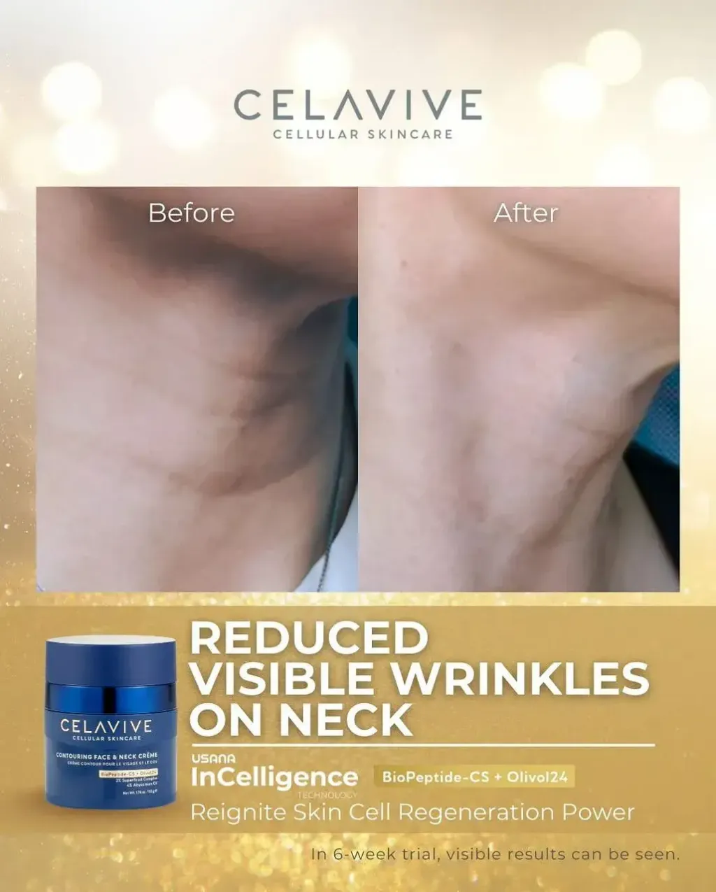 JuzBeauty-JuzBeautyMalaysia-JuzPretty-Authentic-Kbeauty-Malaysia-Skin-Care-Cosmetics-Jbeauty-Health-Care-korean-streetwear-CELAVIVE Lifting Kit 紧致配套9