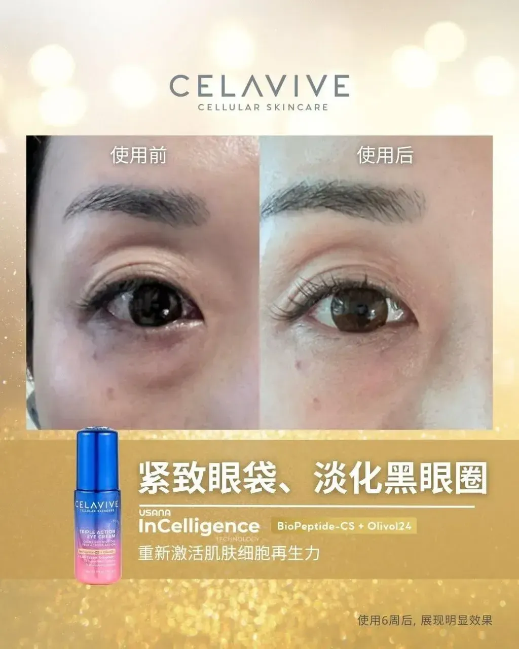 JuzBeauty-JuzBeautyMalaysia-JuzPretty-Authentic-Kbeauty-Malaysia-Skin-Care-Cosmetics-Jbeauty-Health-Care-korean-streetwear-CELAVIVE Lifting Kit 紧致配套11