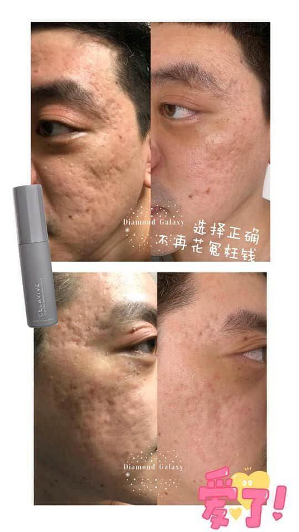 JuzBeauty-JuzBeautyMalaysia-JuzPretty-Authentic-Kbeauty-Malaysia-Skin-Care-Cosmetics-Jbeauty-Health-Care-korean-streetwear-CELAVIVE Premium Pack 终极护肤配套6