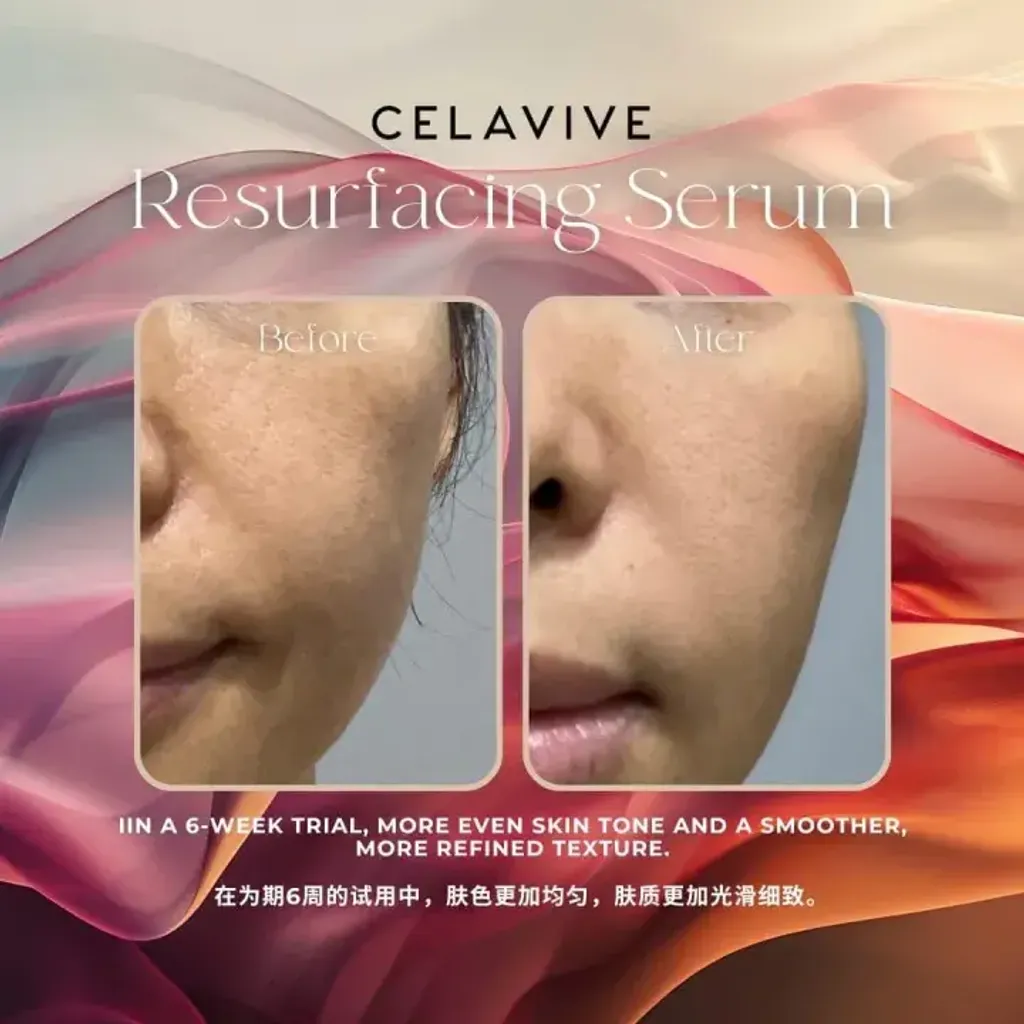 JuzBeauty-JuzBeautyMalaysia-JuzPretty-Authentic-Kbeauty-Malaysia-Skin-Care-Cosmetics-Jbeauty-Health-Care-korean-streetwear-CELAVIVE Resurfacing 4-in-1 Serum 焕肤精华液14