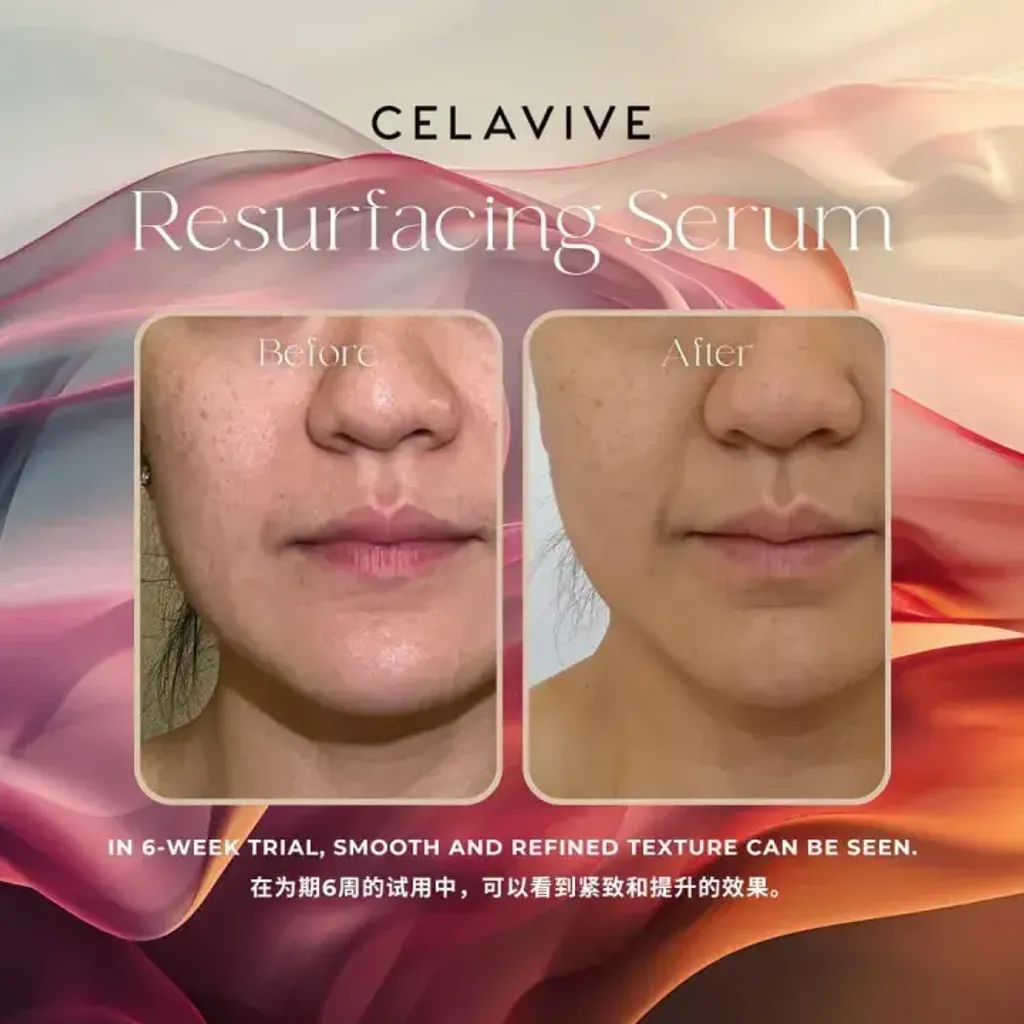 JuzBeauty-JuzBeautyMalaysia-JuzPretty-Authentic-Kbeauty-Malaysia-Skin-Care-Cosmetics-Jbeauty-Health-Care-korean-streetwear-CELAVIVE Resurfacing 4-in-1 Serum 焕肤精华液15