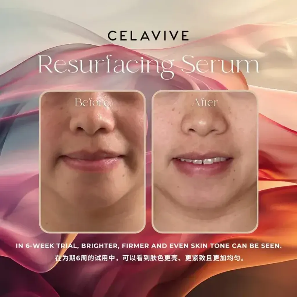 JuzBeauty-JuzBeautyMalaysia-JuzPretty-Authentic-Kbeauty-Malaysia-Skin-Care-Cosmetics-Jbeauty-Health-Care-korean-streetwear-CELAVIVE Resurfacing 4-in-1 Serum 焕肤精华液16