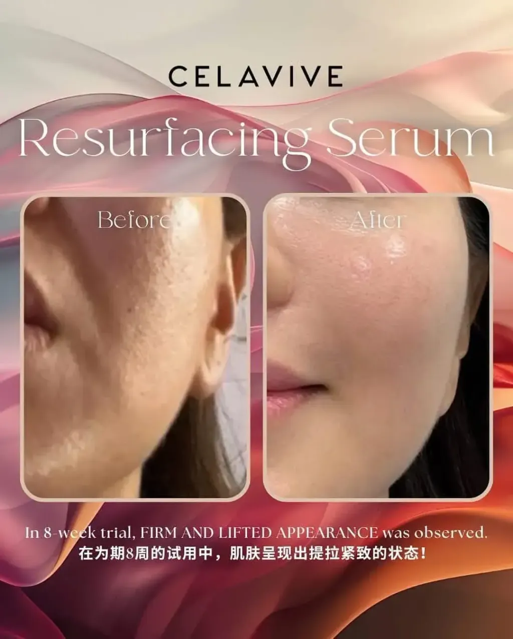 JuzBeauty-JuzBeautyMalaysia-JuzPretty-Authentic-Kbeauty-Malaysia-Skin-Care-Cosmetics-Jbeauty-Health-Care-korean-streetwear-CELAVIVE Resurfacing 4-in-1 Serum 焕肤精华液3
