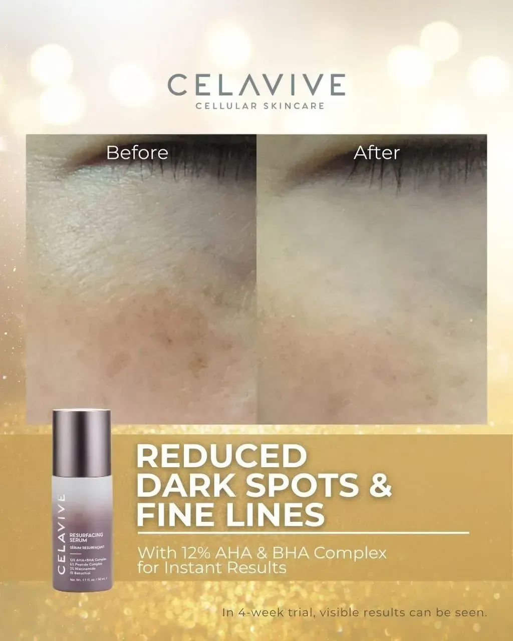 JuzBeauty-JuzBeautyMalaysia-JuzPretty-Authentic-Kbeauty-Malaysia-Skin-Care-Cosmetics-Jbeauty-Health-Care-korean-streetwear-CELAVIVE Resurfacing 4-in-1 Serum 焕肤精华液24