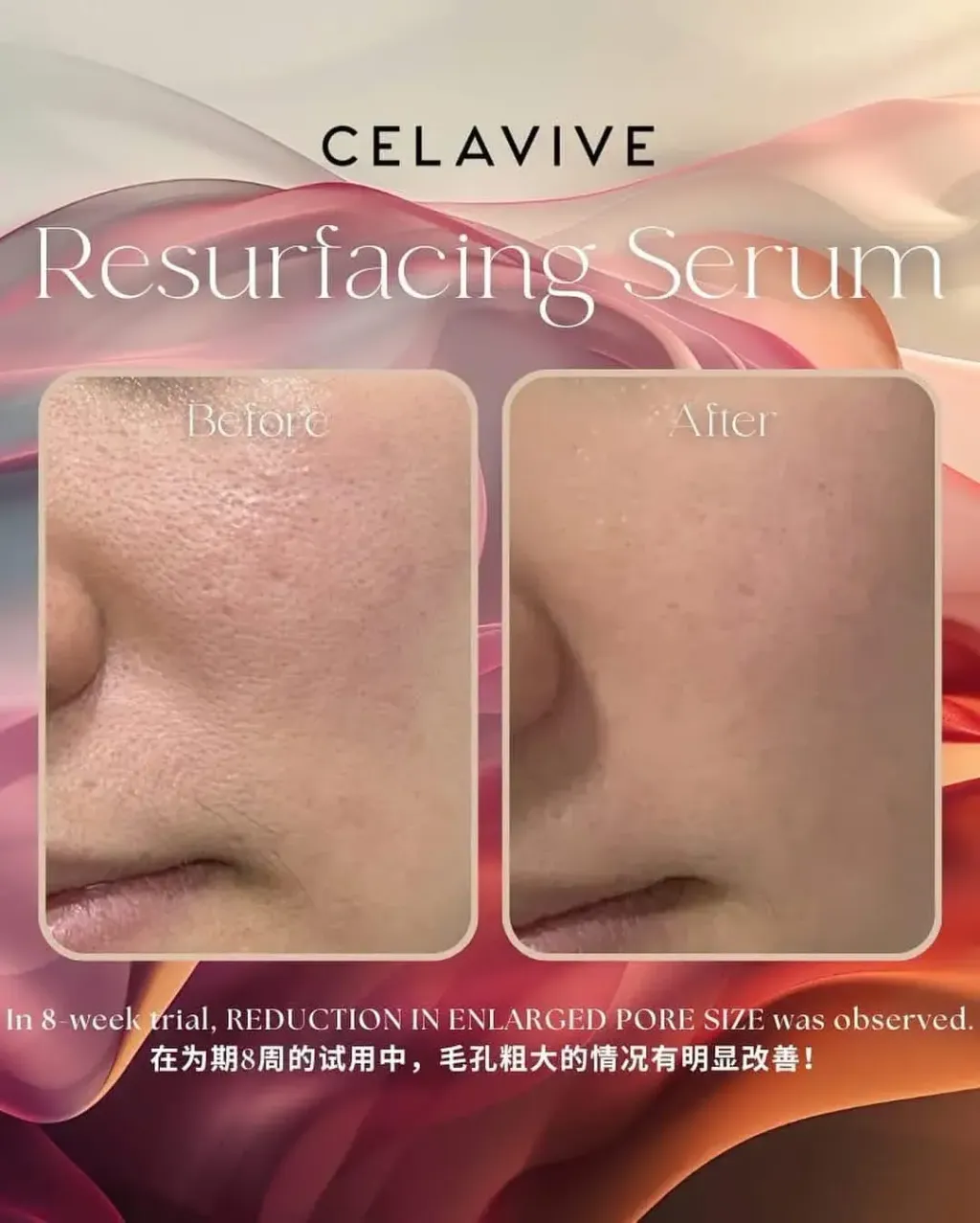 JuzBeauty-JuzBeautyMalaysia-JuzPretty-Authentic-Kbeauty-Malaysia-Skin-Care-Cosmetics-Jbeauty-Health-Care-korean-streetwear-CELAVIVE Resurfacing 4-in-1 Serum 焕肤精华液4