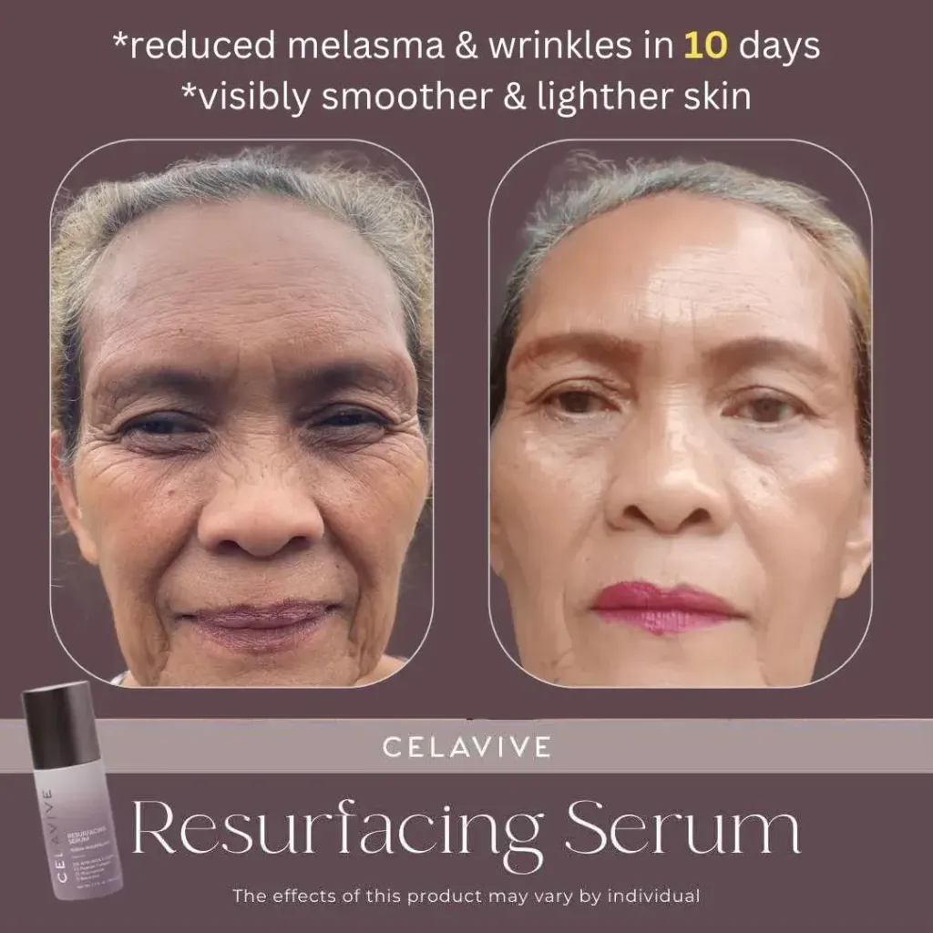 JuzBeauty-JuzBeautyMalaysia-JuzPretty-Authentic-Kbeauty-Malaysia-Skin-Care-Cosmetics-Jbeauty-Health-Care-korean-streetwear-CELAVIVE Resurfacing 4-in-1 Serum 焕肤精华液6