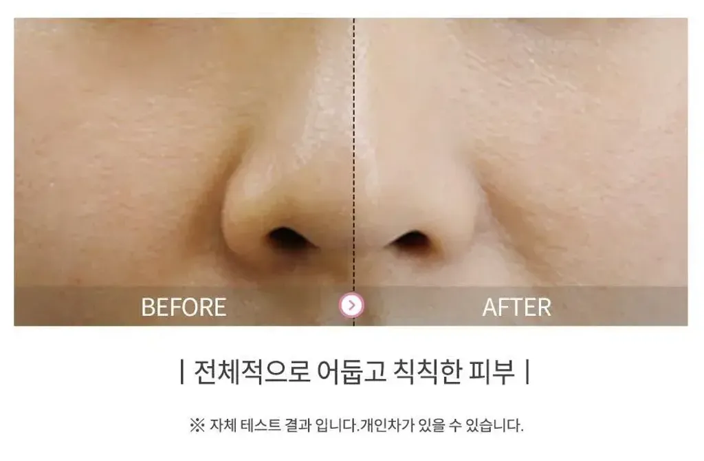 JuzBeauty_JuzBeautyMalaysia_JuzPretty_Authentic_Kbeauty_Malaysia_Skin_Care_Cosmetics_K-beauty_Health_Care_korean_streetwear_The Yeon Yowoo Cream 3秒狐狸美白霜8