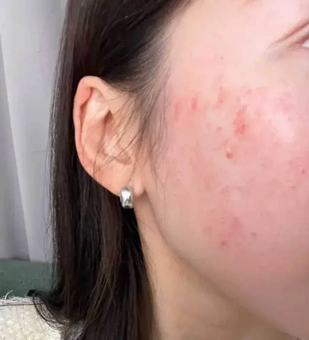 JuzBeauty_JuzBeautyMalaysia_JuzPretty_Authentic_Kbeauty_Malaysia_Skin_Care_Cosmetics_K-beauty_Health_Care_korean_streetwear_KIOSKIN D-Panthenol 15.5 Cream 泛醇15.5高浓度修护霜10