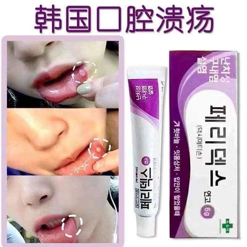 JuzBeauty-JuzBeautyMalaysia-JuzPretty-Authentic-Kbeauty-Malaysia-Skin-Care-Cosmetics-Jbeauty-Health-Care-korean-streetwear-GC Peridex Ointment for the Oral Cavity Disease 口腔溃疡膏12