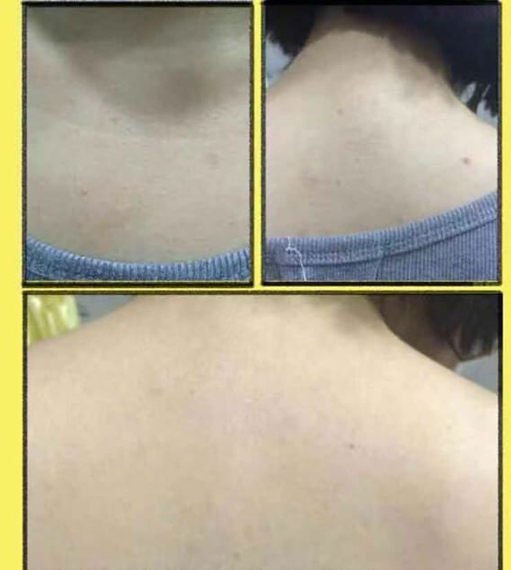 JuzBeauty_JuzBeautyMalaysia_JuzPretty_Authentic_Kbeauty_Malaysia_Skin_Care_Cosmetics_Jbeauty_Australia_Health_Care_Merphil_AC_Magic_Cleanser_ (6).jpg