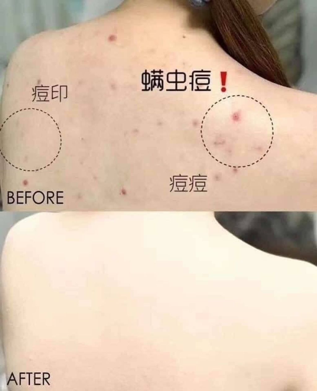 JuzBeauty_JuzBeautyMalaysia_JuzPretty_Authentic_Kbeauty_Malaysia_Skin_Care_Cosmetics_Jbeauty_Australia_Health_Care_Merphil_AC_Magic_Cleanser_ (10).jpg