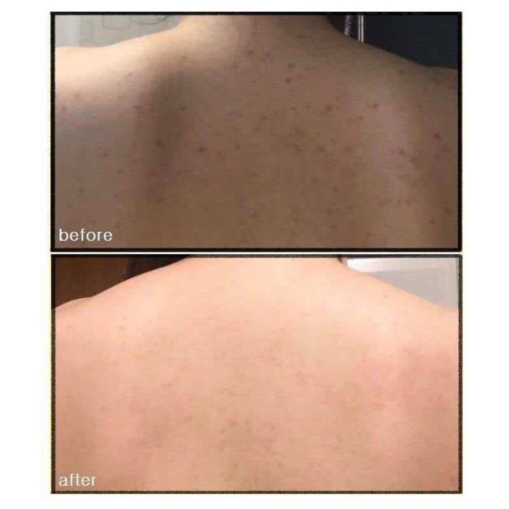 JuzBeauty_JuzBeautyMalaysia_JuzPretty_Authentic_Kbeauty_Malaysia_Skin_Care_Cosmetics_Jbeauty_Australia_Health_Care_Merphil_AC_Magic_Cleanser_ (3).jpg