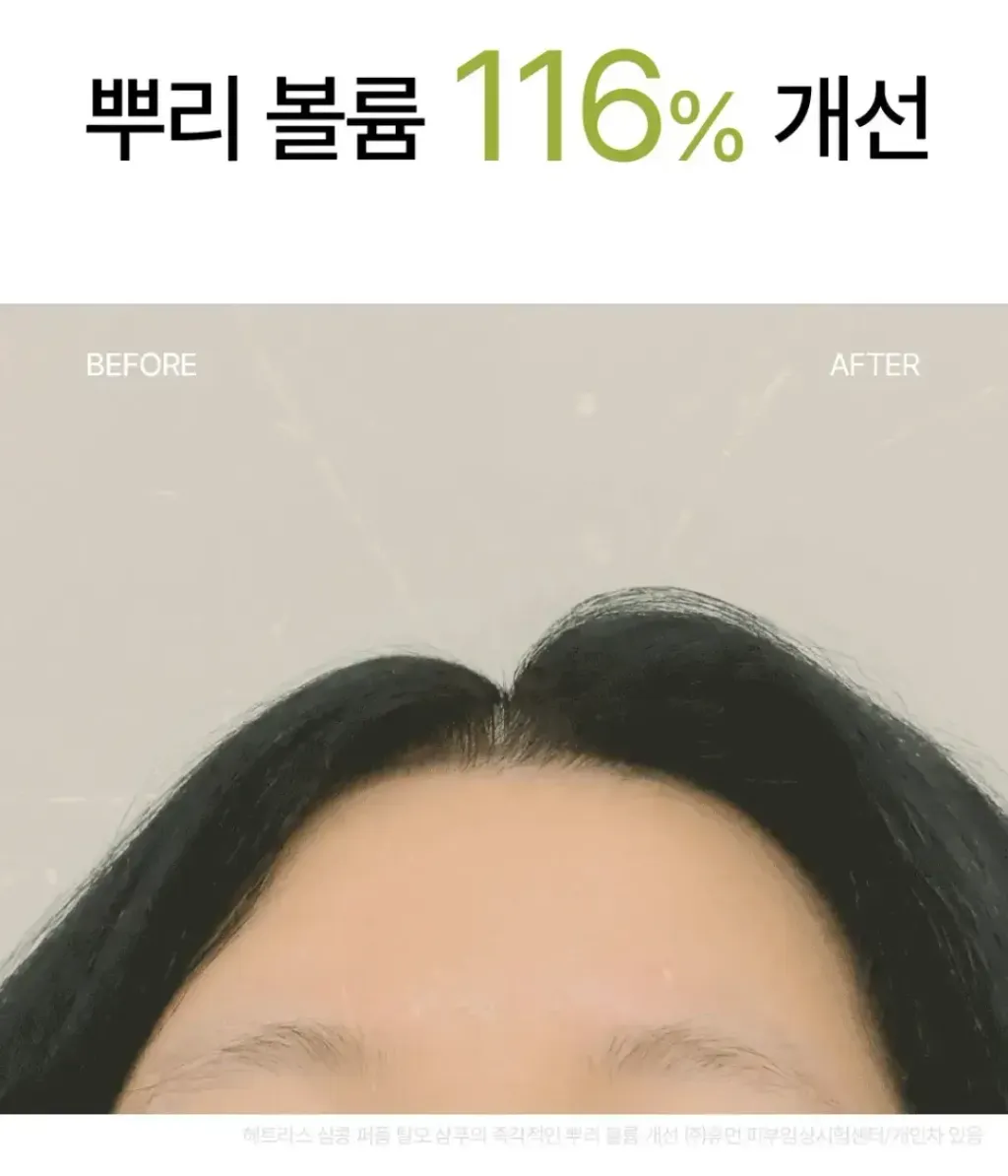 JuzBeauty-JuzBeautyMalaysia-JuzPretty-Authentic-Kbeauty-Malaysia-Skin-Care-Cosmetics-Jbeauty-Health-Care-korean-streetwear-hetras Simkong Perfume Anti-Hair Loss Shampoo 防脱洗发水22