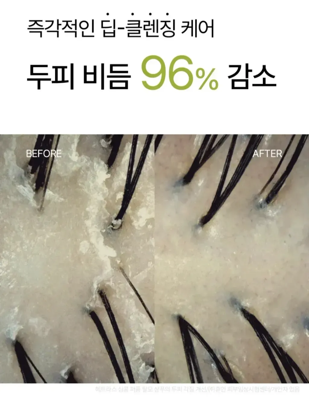 JuzBeauty-JuzBeautyMalaysia-JuzPretty-Authentic-Kbeauty-Malaysia-Skin-Care-Cosmetics-Jbeauty-Health-Care-korean-streetwear-hetras Simkong Perfume Anti-Hair Loss Shampoo 防脱洗发水21