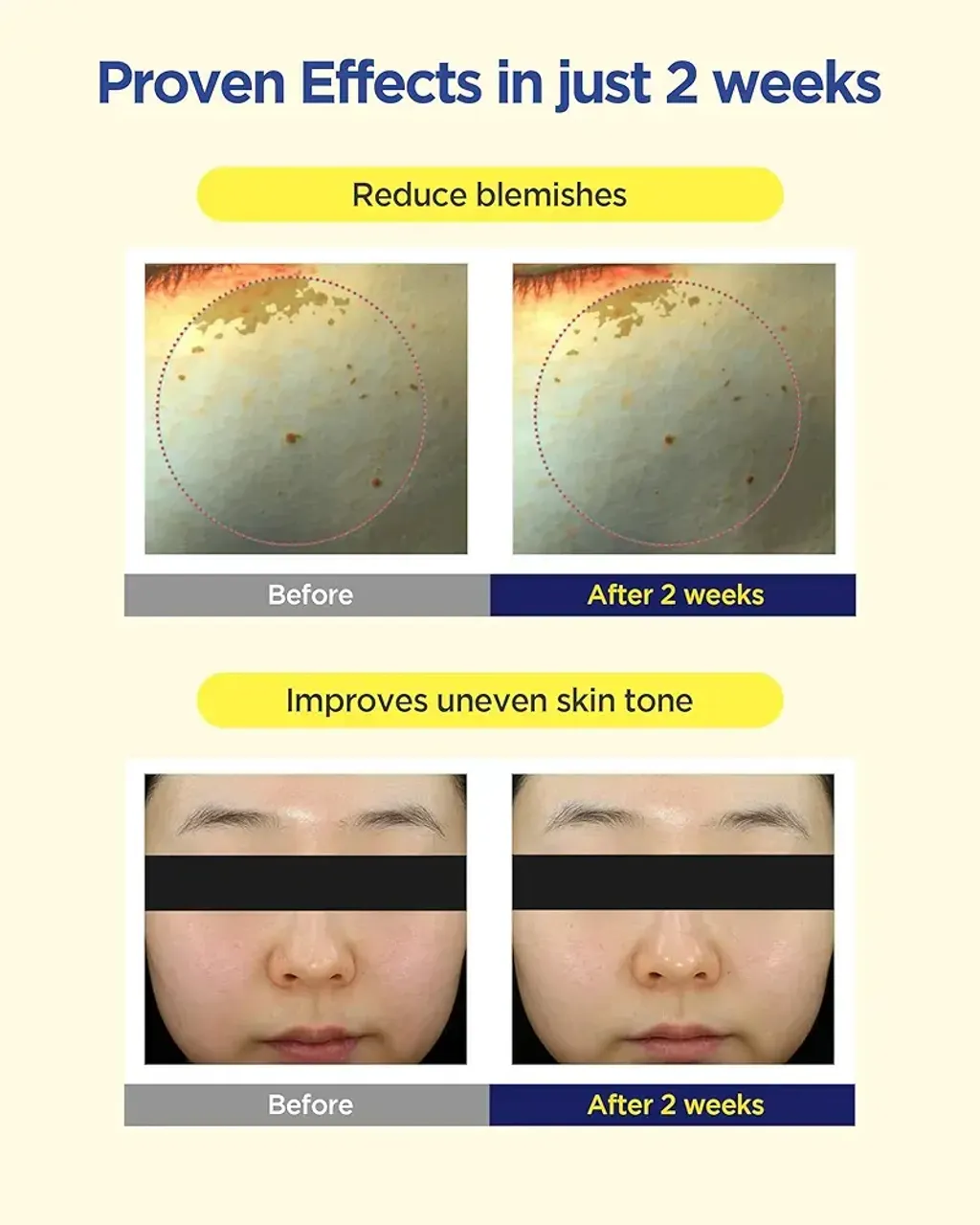 JuzBeauty_JuzBeautyMalaysia_JuzPretty_Authentic_Kbeauty_Malaysia_Skin_Care_Cosmetics_K-beauty_Health_Care_korean_streetwear_CKD Healthcare Vita C Teca Blemish Shot Mask Sheet 美白淡斑活性微针凝胶面膜1