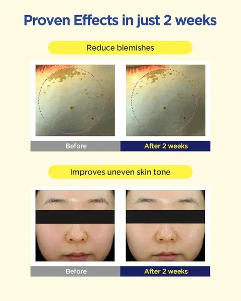 JuzBeauty_JuzBeautyMalaysia_JuzPretty_Authentic_Kbeauty_Malaysia_Skin_Care_Cosmetics_K-beauty_Health_Care_korean_streetwear_CKD Healthcare Vita C Teca Blemish Shot Mask Sheet 美白淡斑活性微针凝胶面膜1