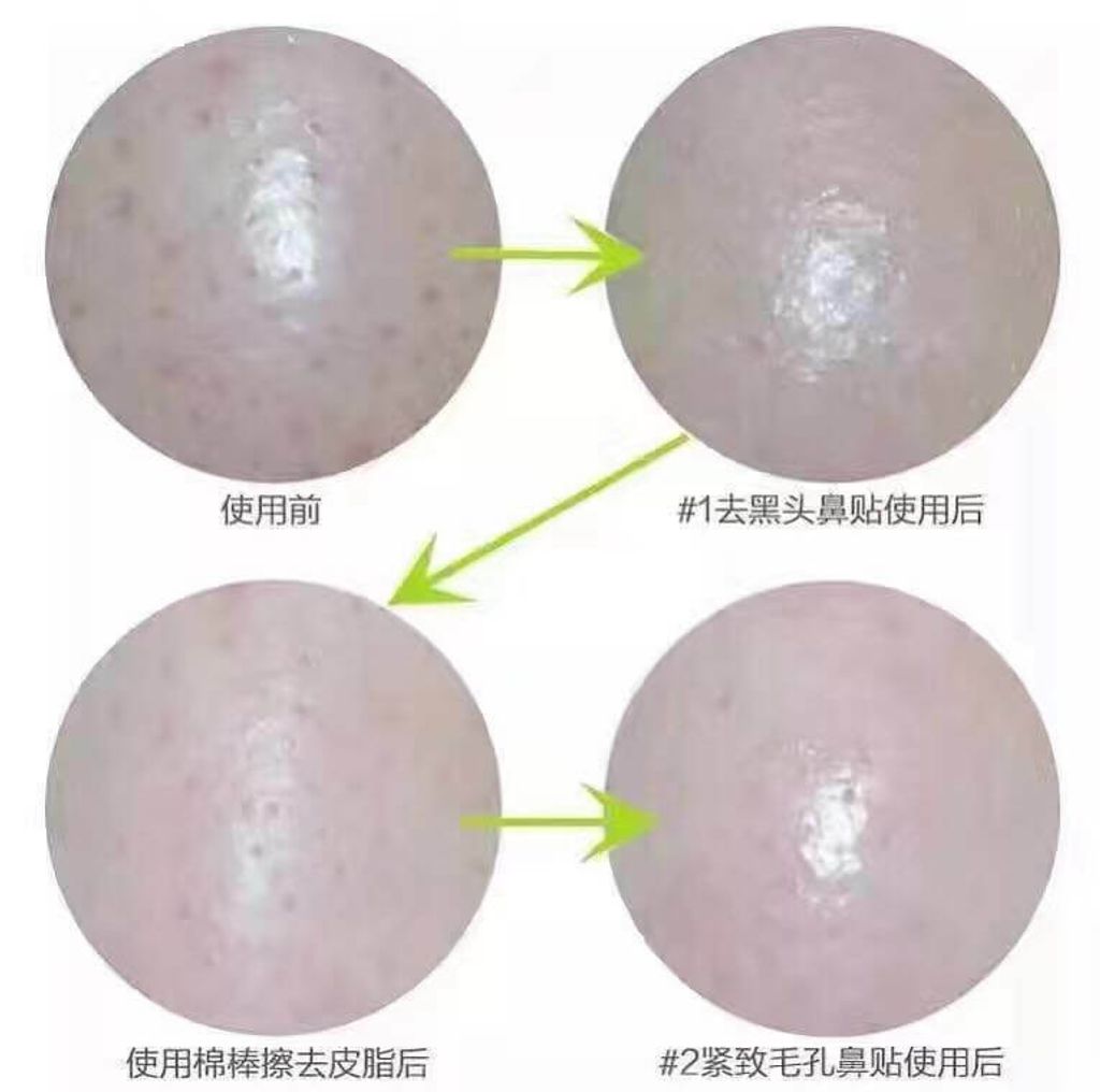 JuzBeauty_JuzBeautyMalaysia_JuzPretty_Authentic_Kbeauty_Malaysia_Jbeauty_Australia_Health_Care_CNP_Laboratory_Anti-pore_Black_Head_Clear_Kit_ (4).jpg