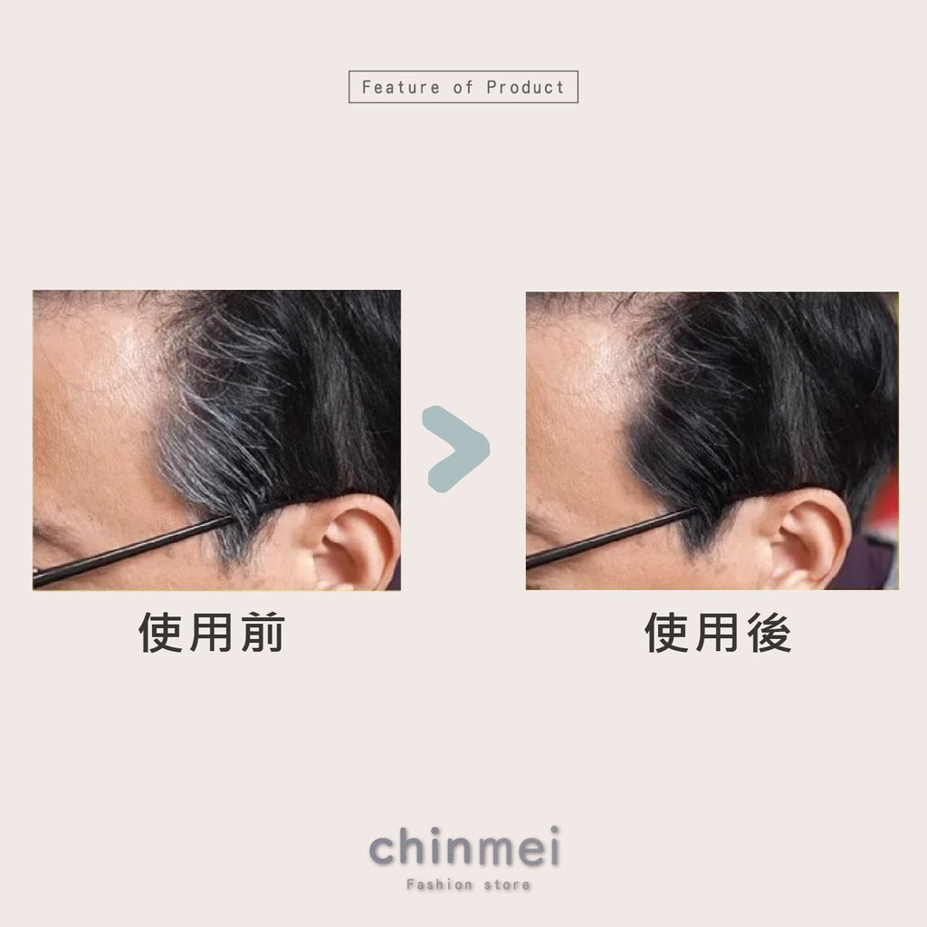 晴美-03