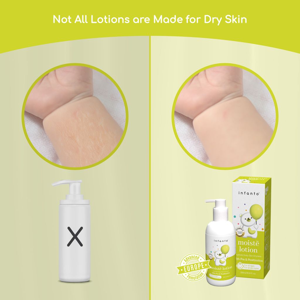 Moiste Lotion - POSM-03