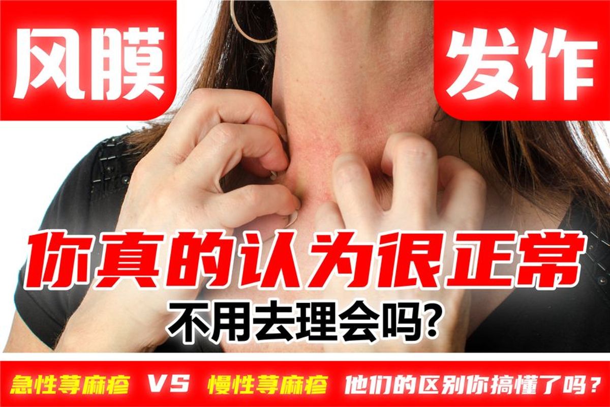 急性荨麻疹 VS 慢性荨麻疹 他们的区别你搞懂了吗？