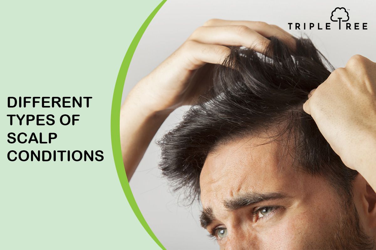 Scalp Conditions: Symptoms and Causes