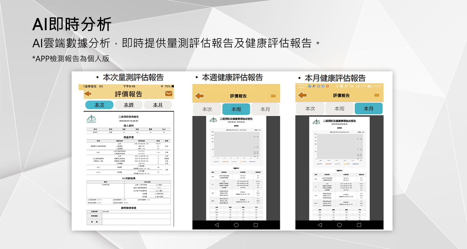心壓計(心電、血壓雙監測)-AI即時分析