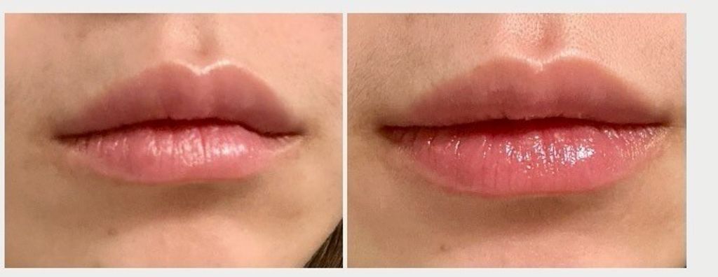 562333764_1586751962315797_2839514897850417889_n