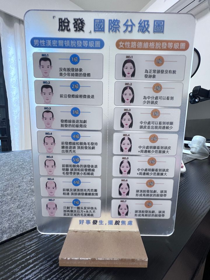 男女生脫髮壓克力板