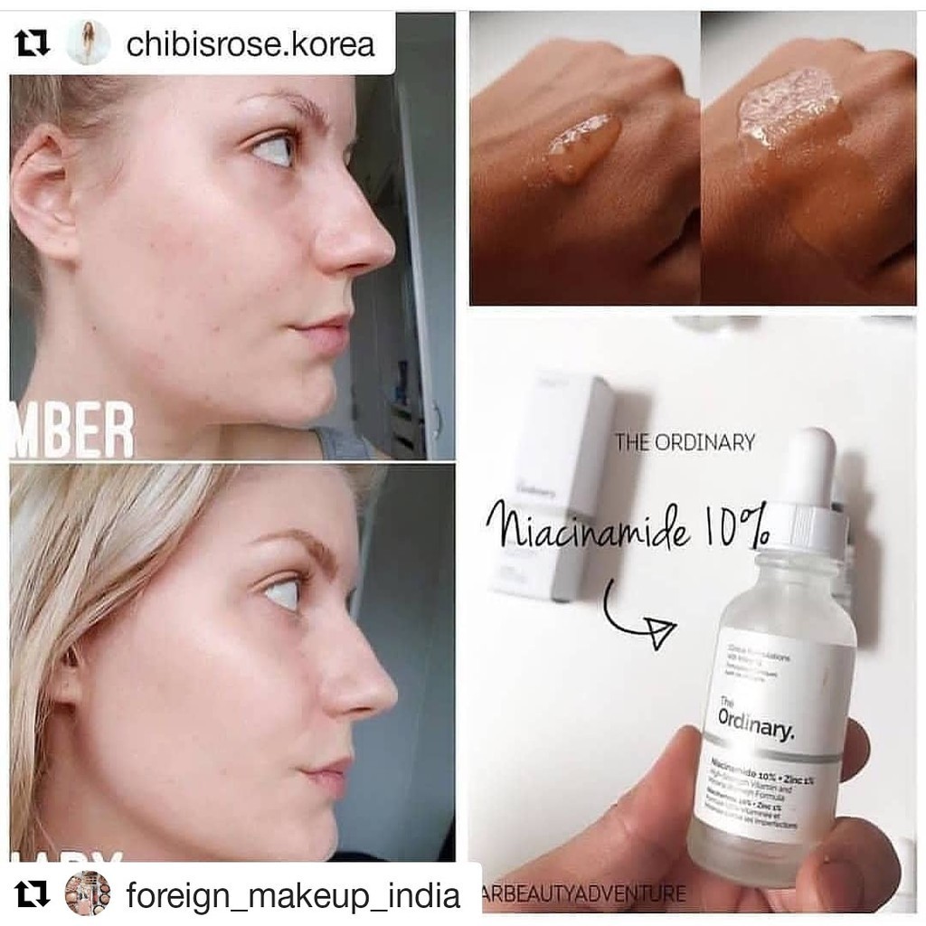 benzoyl peroxide ordinary