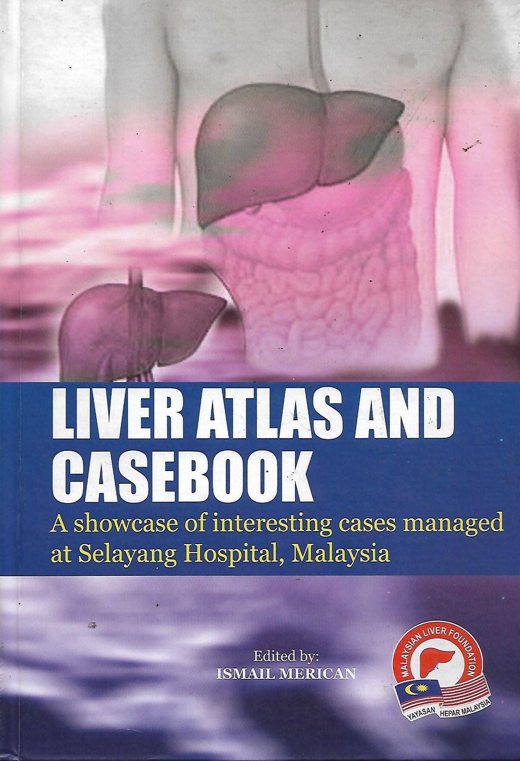 liver 1