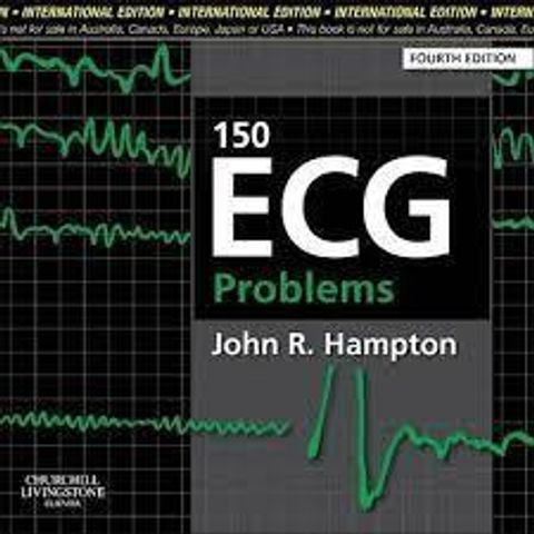 ecg