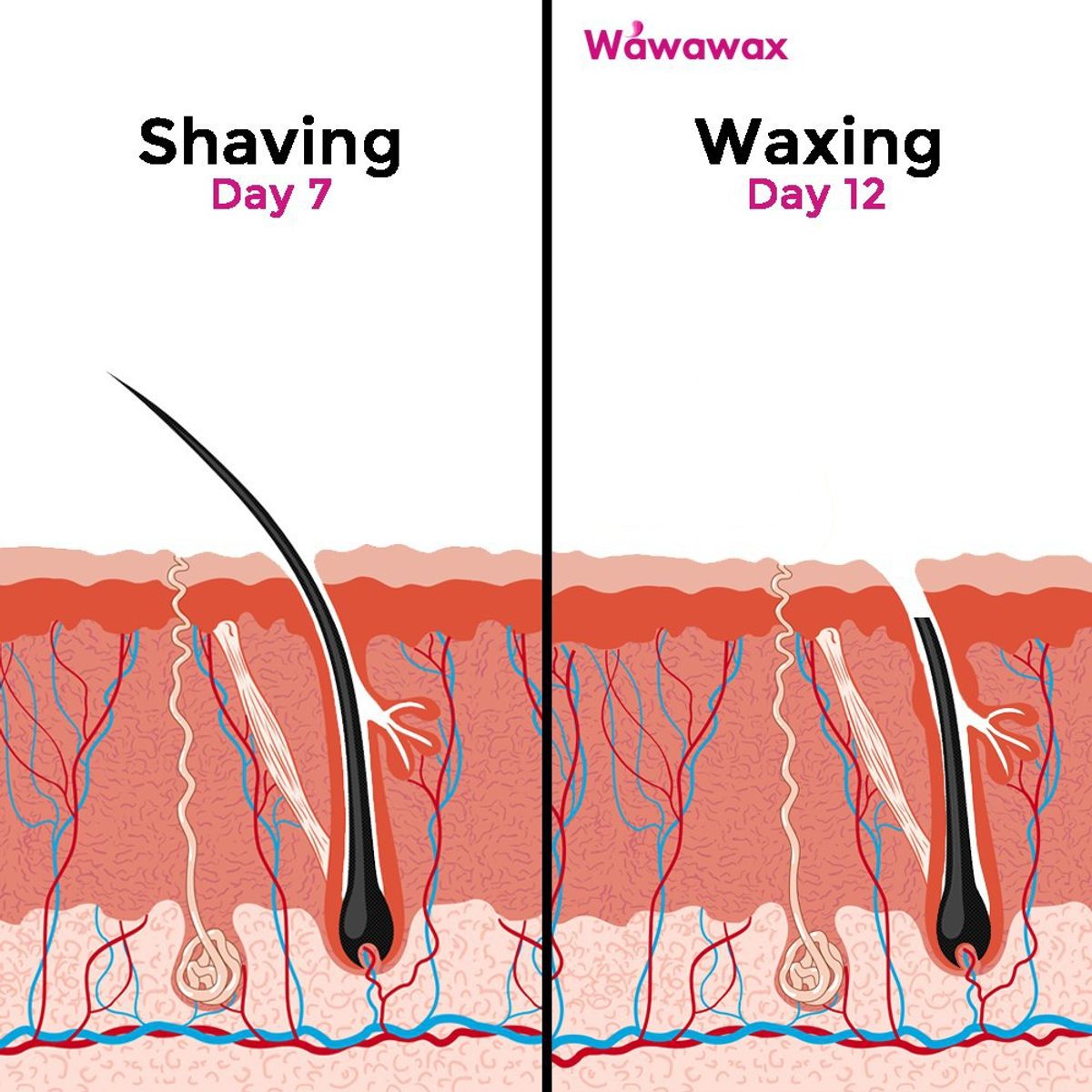 5 Sebab Anda Perlu WAXING Bukan SHAVING (hair removal/cabut bulu)