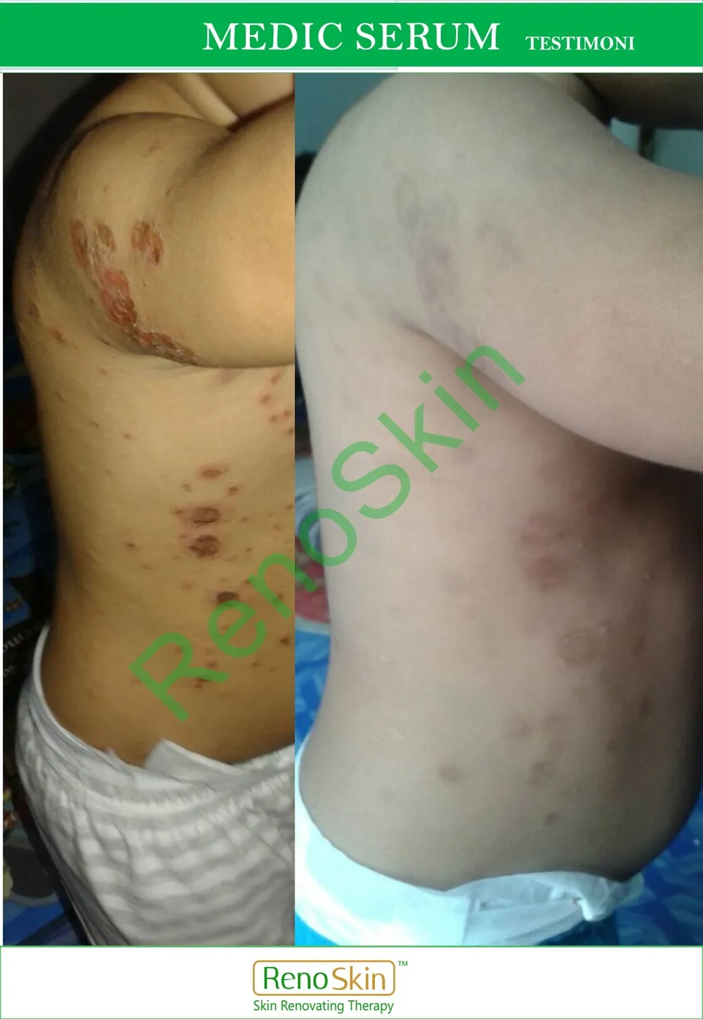 Before After picture new.jpg