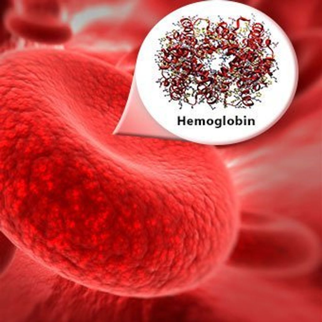 hemoglobin-s7-thalassemia.jpg