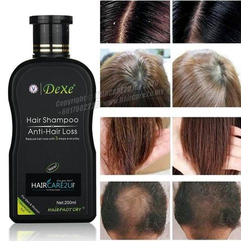 200ml Dexe Anti Hair Loss Shampoo 7.jpg