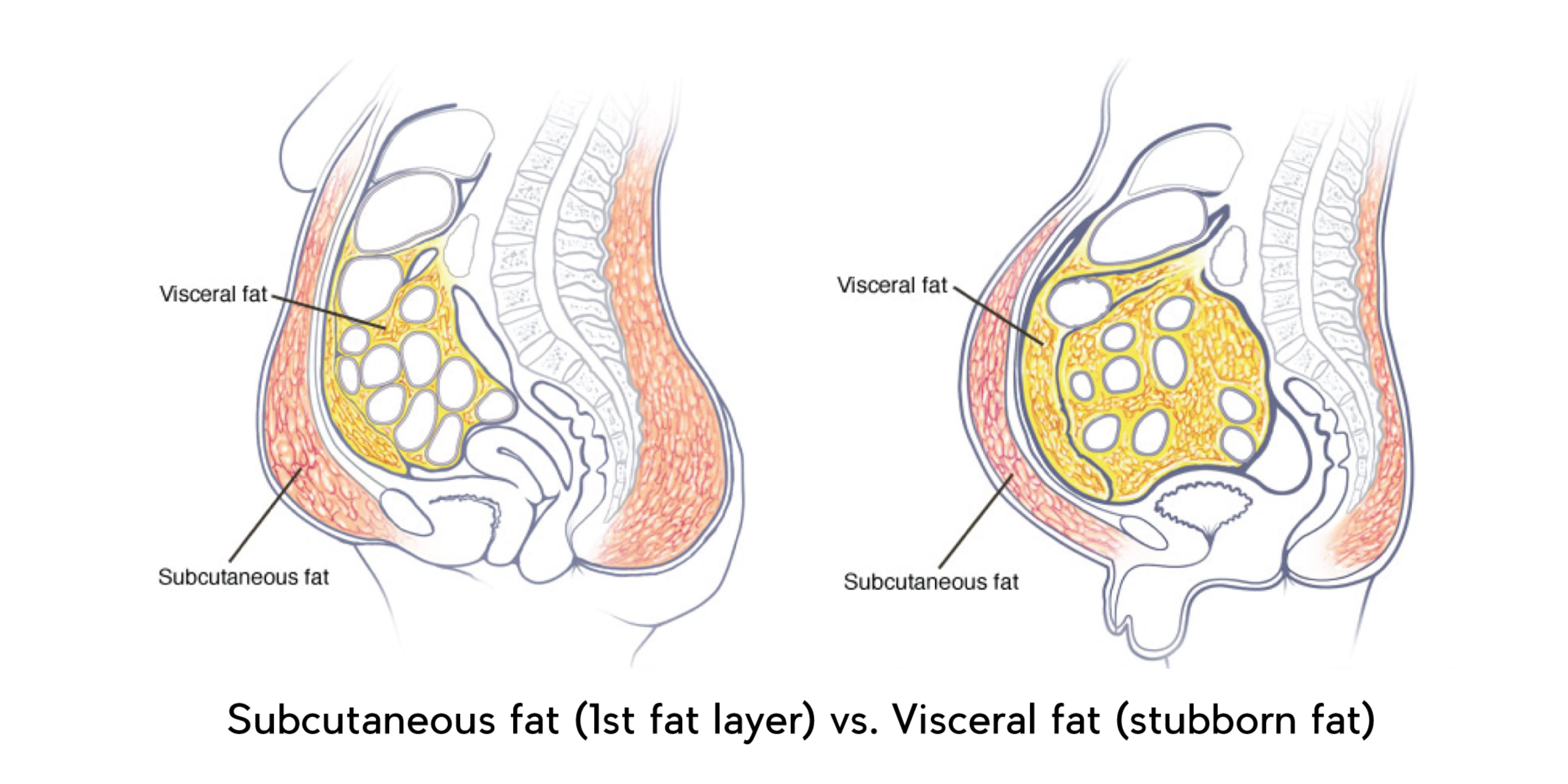 COCOLAB Trimmax Belly Fat Burner - Subcutaneous vs Visceral Fat
