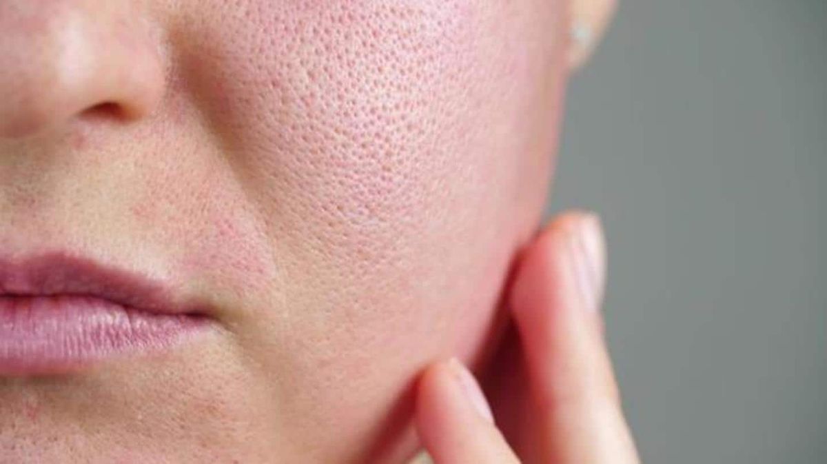 3 easy way to shrink enlarged pores