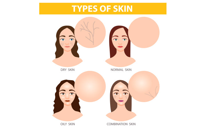 types of skin.jpg