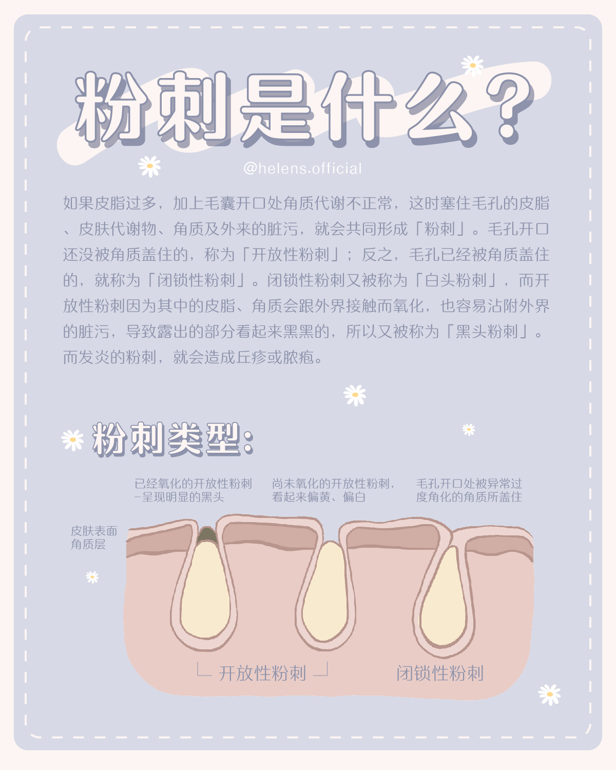 【去闭口粉刺】之指南来啦！