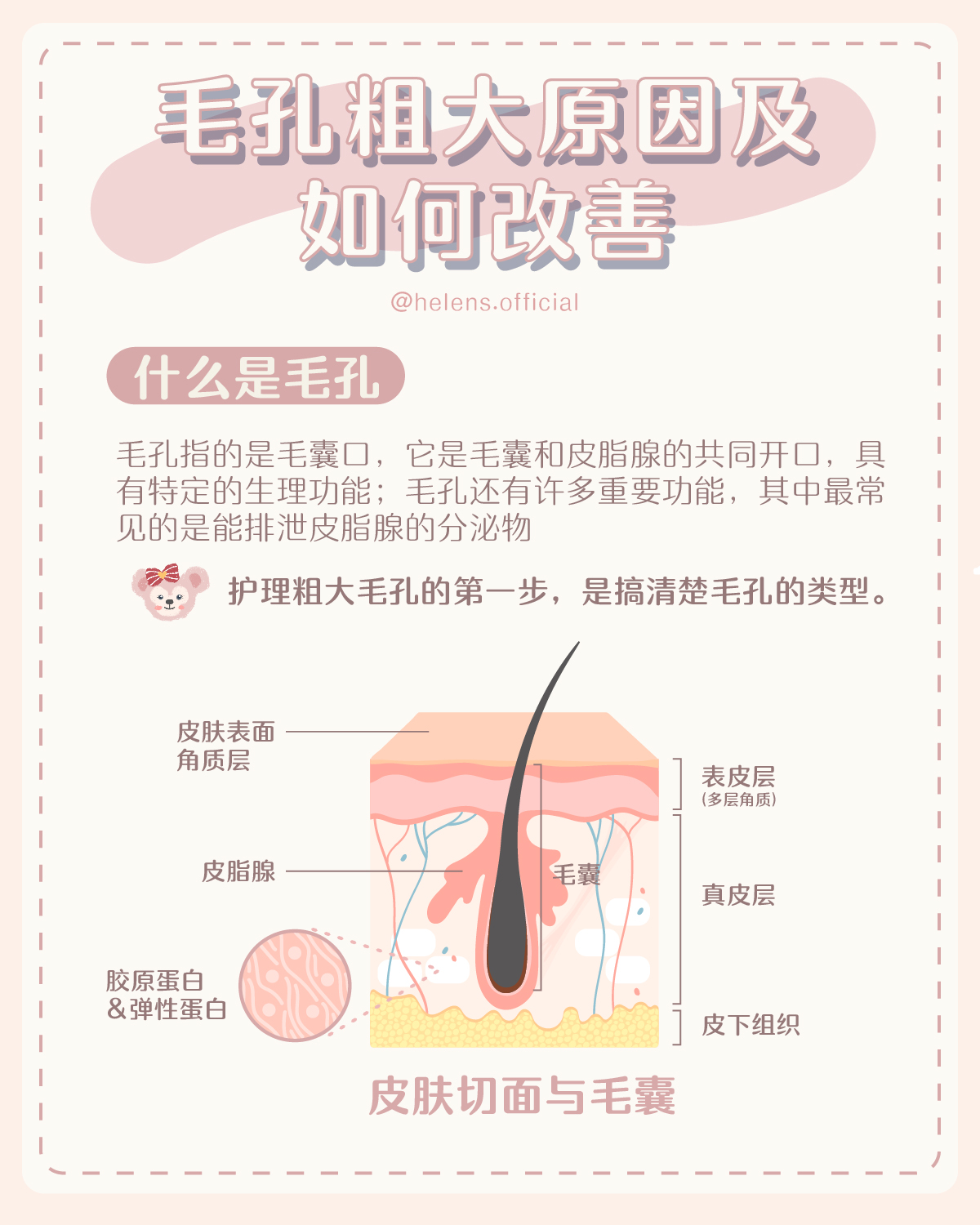 【毛孔粗大知识点】有哪些原因？该怎么解决？