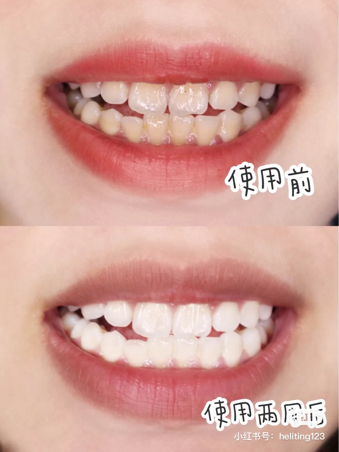 5CE77C7D-528D-4AA8-9A23-CABE9B1F8790.jpeg