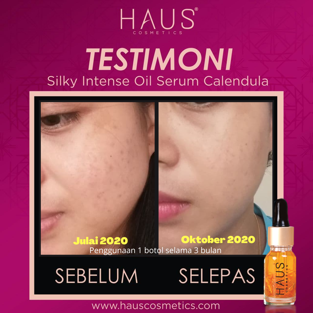 testimoni oil serum 6