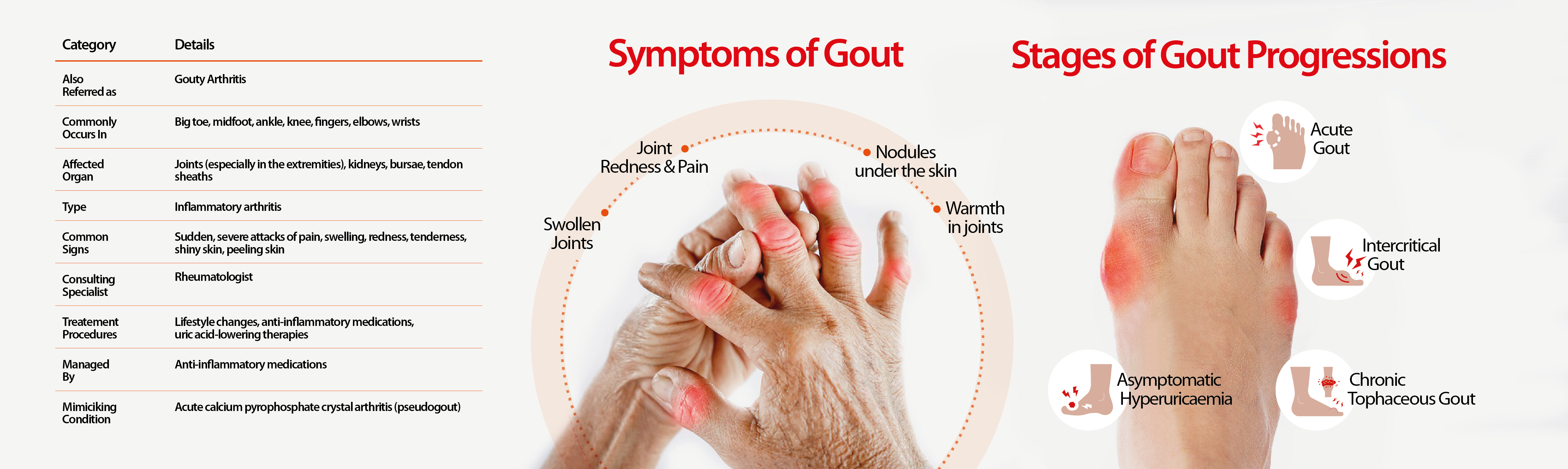 ACUREX easystore-page