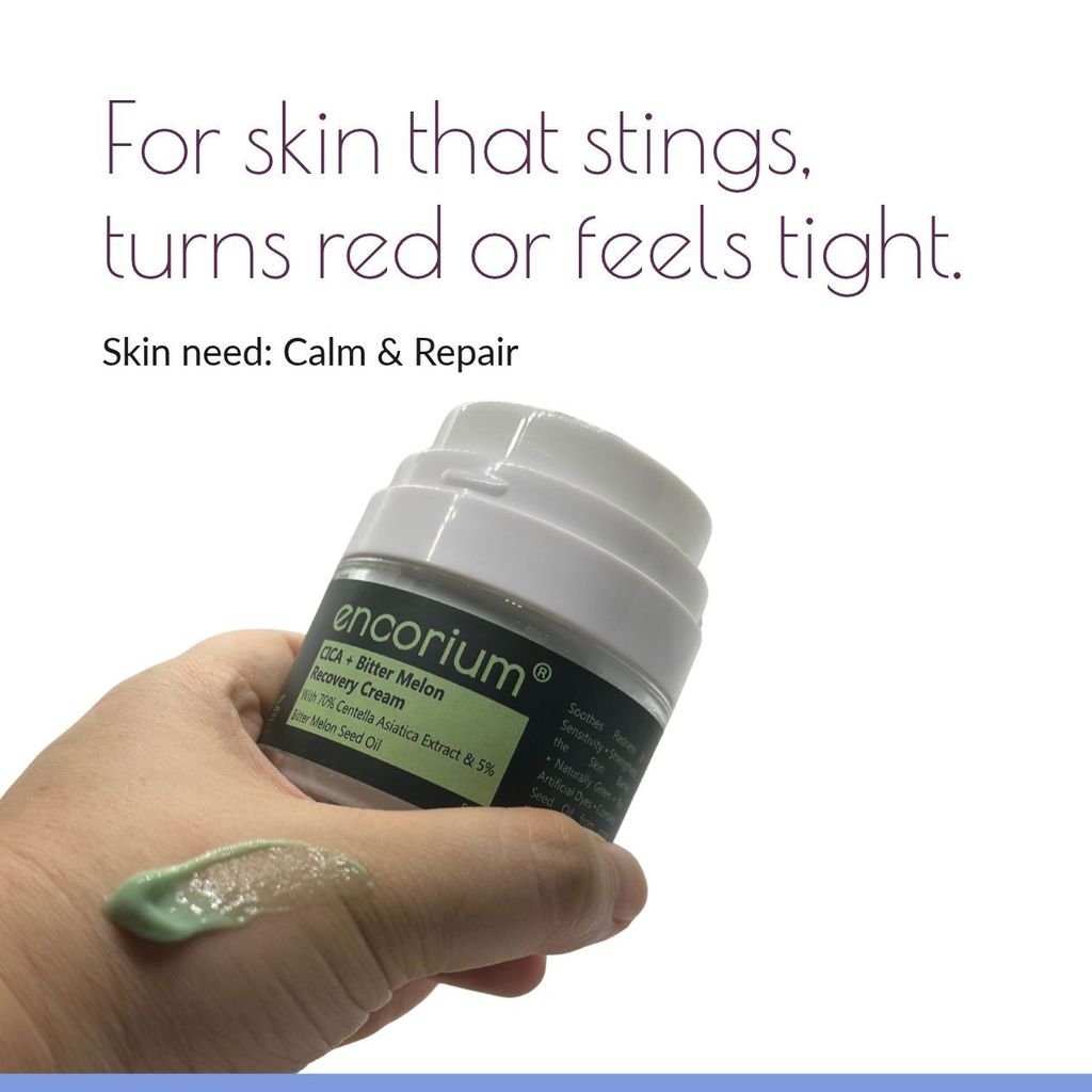 Hand holding Encorium CICA + Bitter Melon Recovery Cream with a swatch, for sensitive skin that stings or turns red