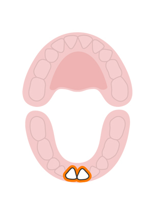 teeth-slideshow-teetheruption-1a.jpeg