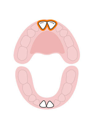 teeth-slideshow-teetheruption-2a.jpeg