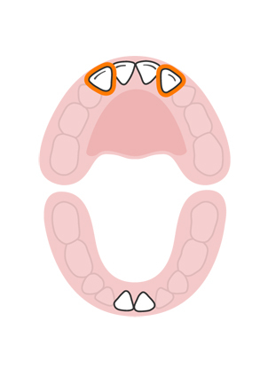 teeth-slideshow-teetheruption-3a.jpeg