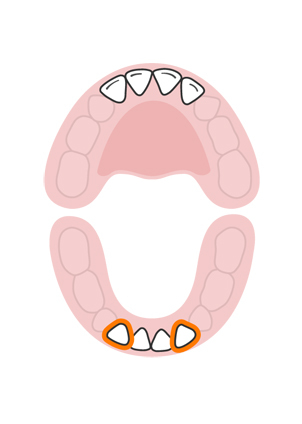 teeth-slideshow-teetheruption-4a.jpeg